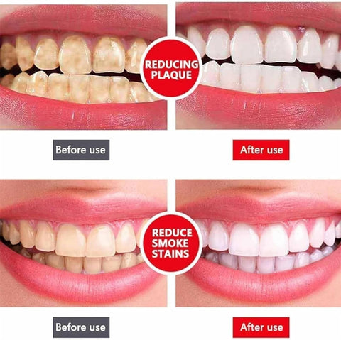 Yayashi Sp-4 Ultra Whitening Toothpaste Probiotic Stain Remover Stain Removing Toothpaste, Protects Gums Freshens Breath, for Everyone - 120 gram