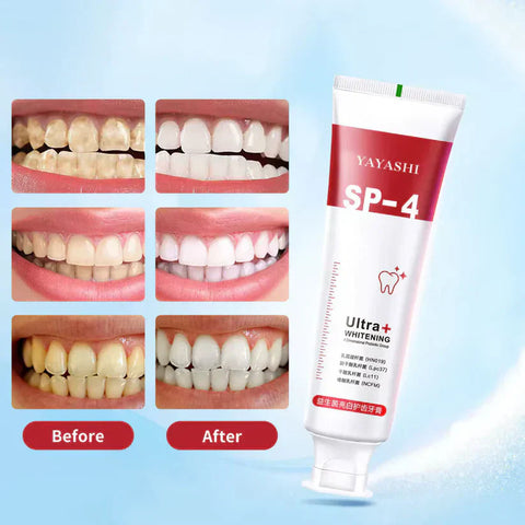 Yayashi Sp-4 Ultra Whitening Toothpaste Probiotic Stain Remover Stain Removing Toothpaste, Protects Gums Freshens Breath, for Everyone - 120 gram